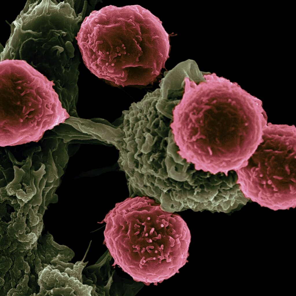 National Cancer Institute Lnvcexqwc O Unsplash