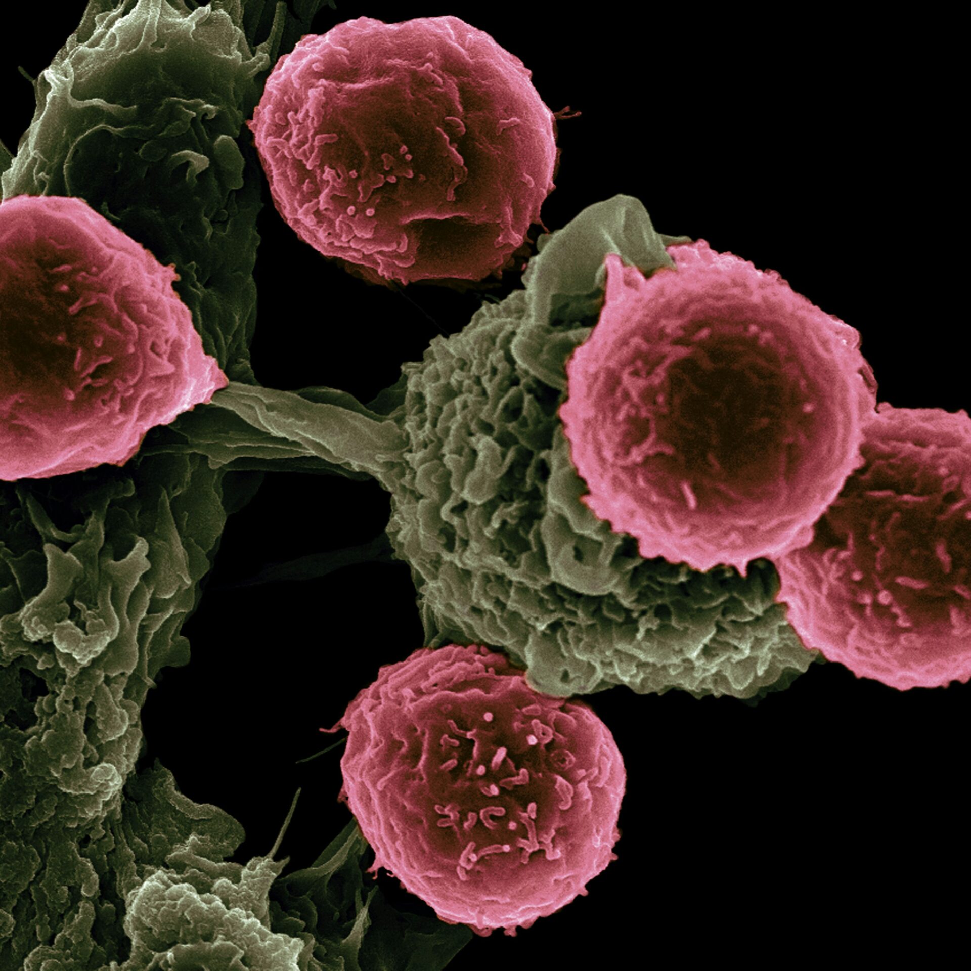 National Cancer Institute Lnvcexqwc O Unsplash